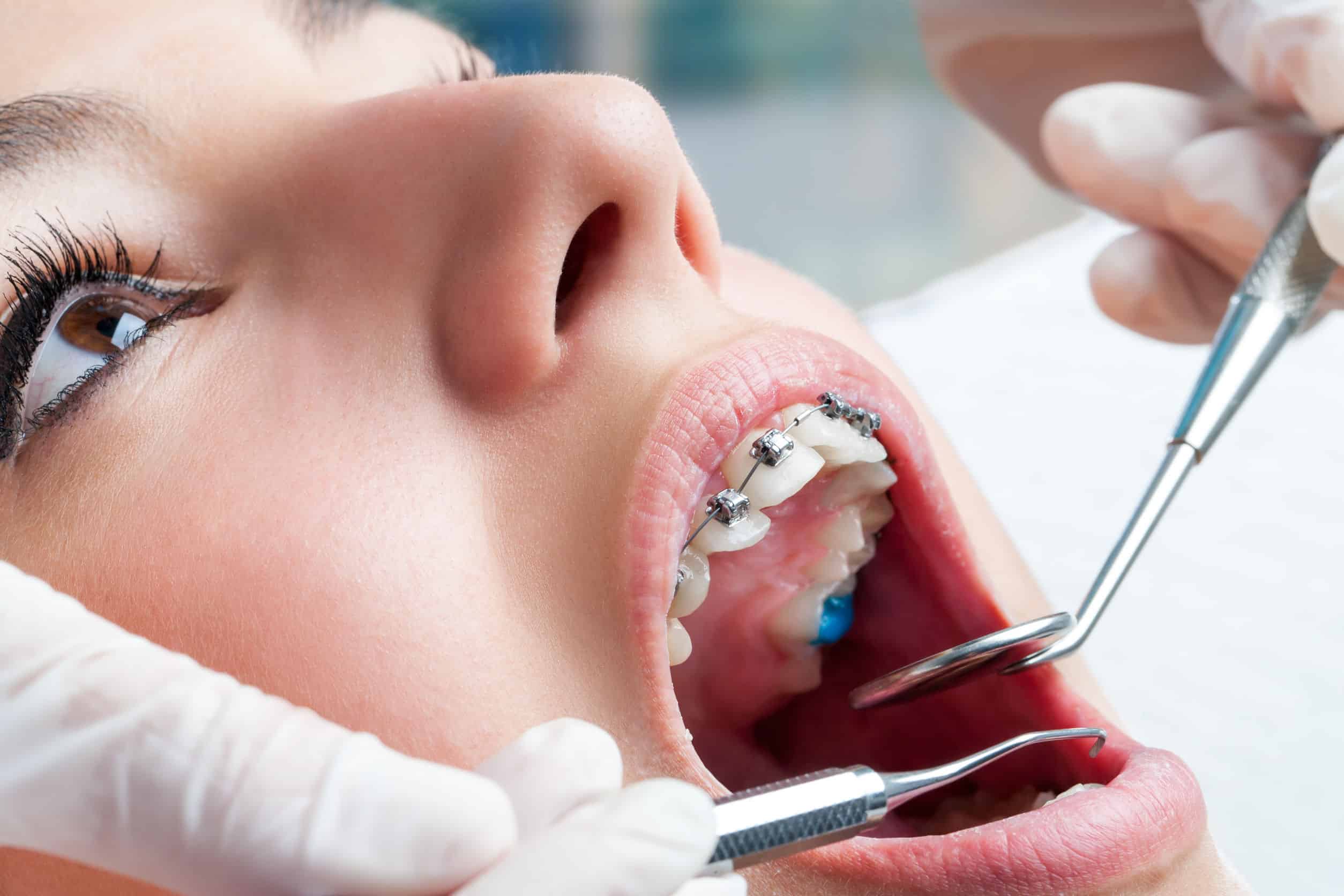 How To Choose The Best Memphis Orthodontist