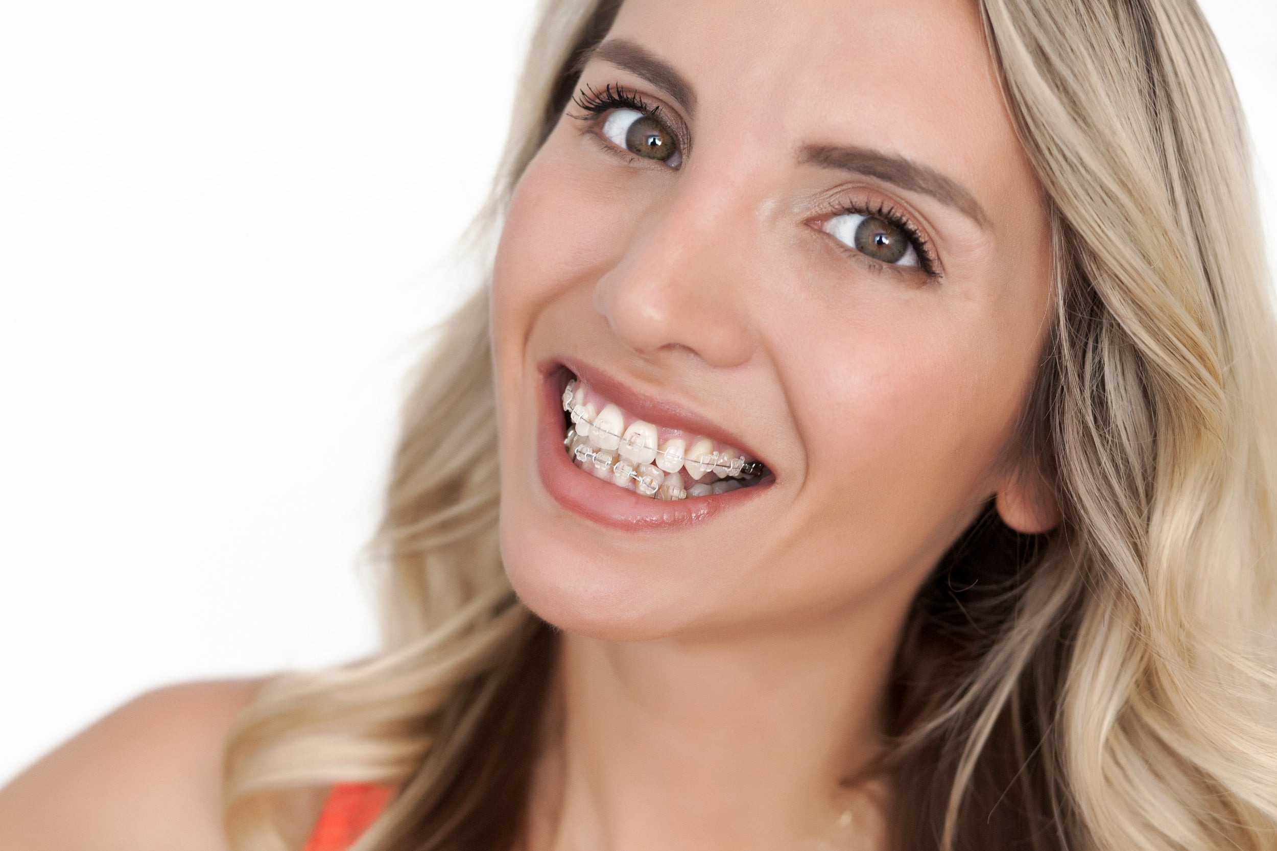 What Are Fast Braces & How They Work Fast to Straighten Teeth